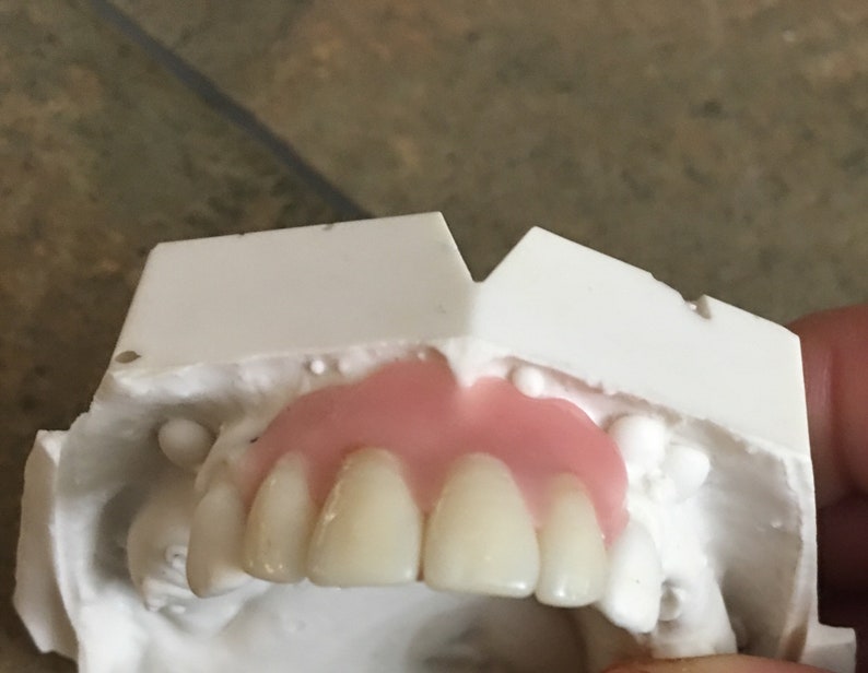 Missing Tooth Kit Front Flipper Denture Resin Denture Teeth Etsy