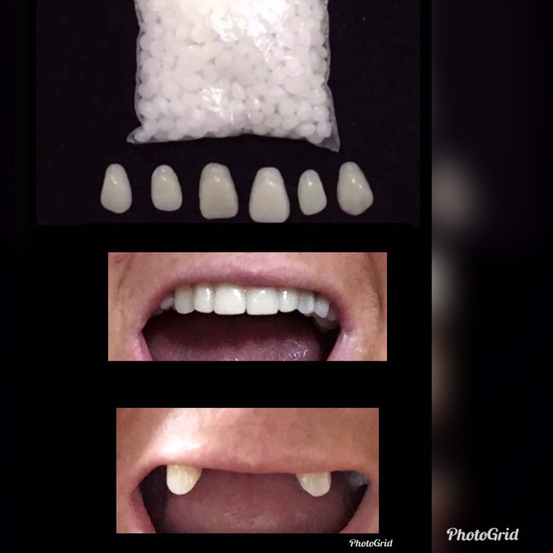 Missing Tooth Kit Front Flipper Denture Resin Denture Teeth Etsy
