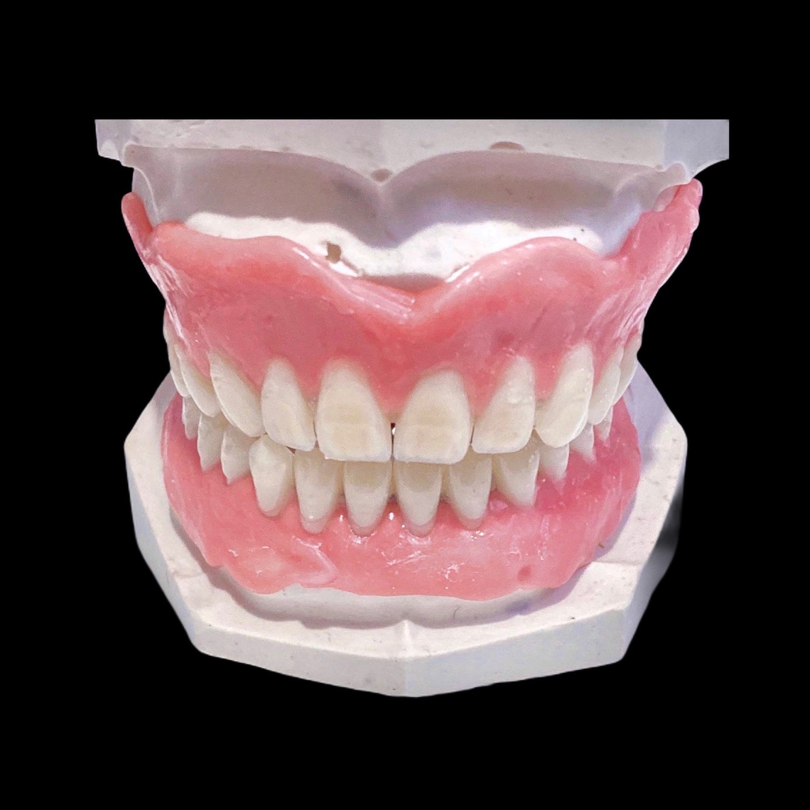 DIY Kit Denture Resin Teeth Upper & Lower Best Denture Kit Etsy