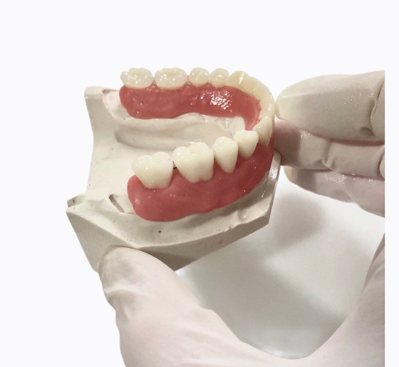 dental putty dental putty