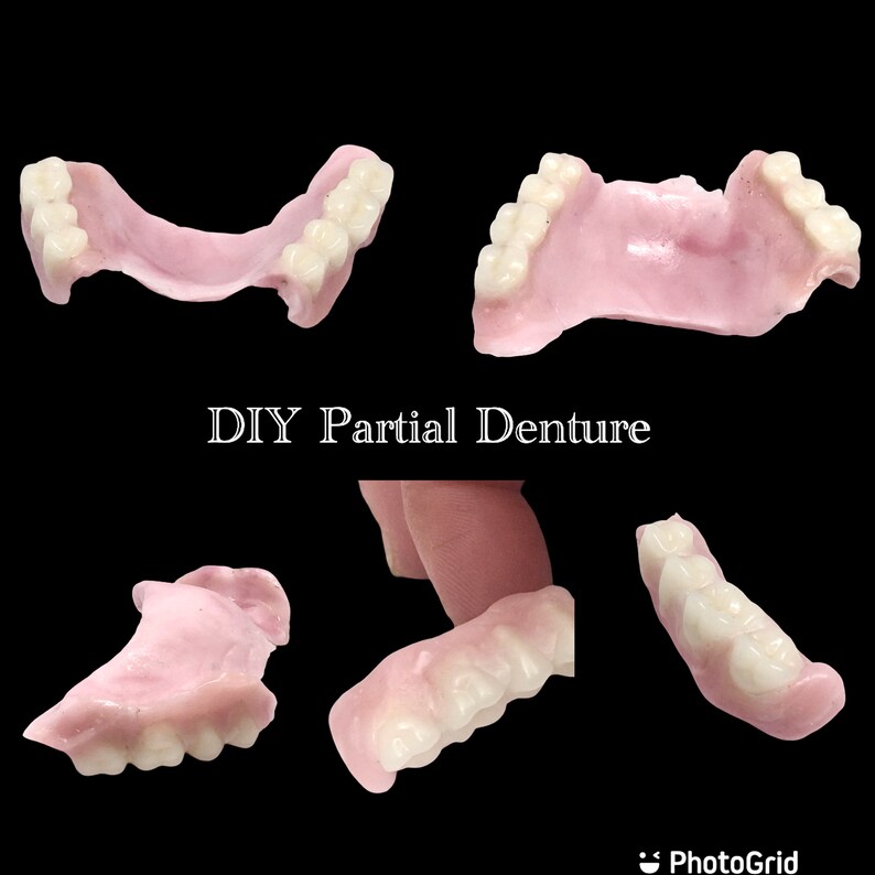 DIY Partial Denture Kit Dental Bridge Flipper Teeth Acrylic Etsy