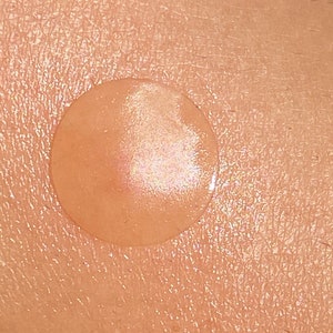 Mollenol Hydrocolloid Patches image 3