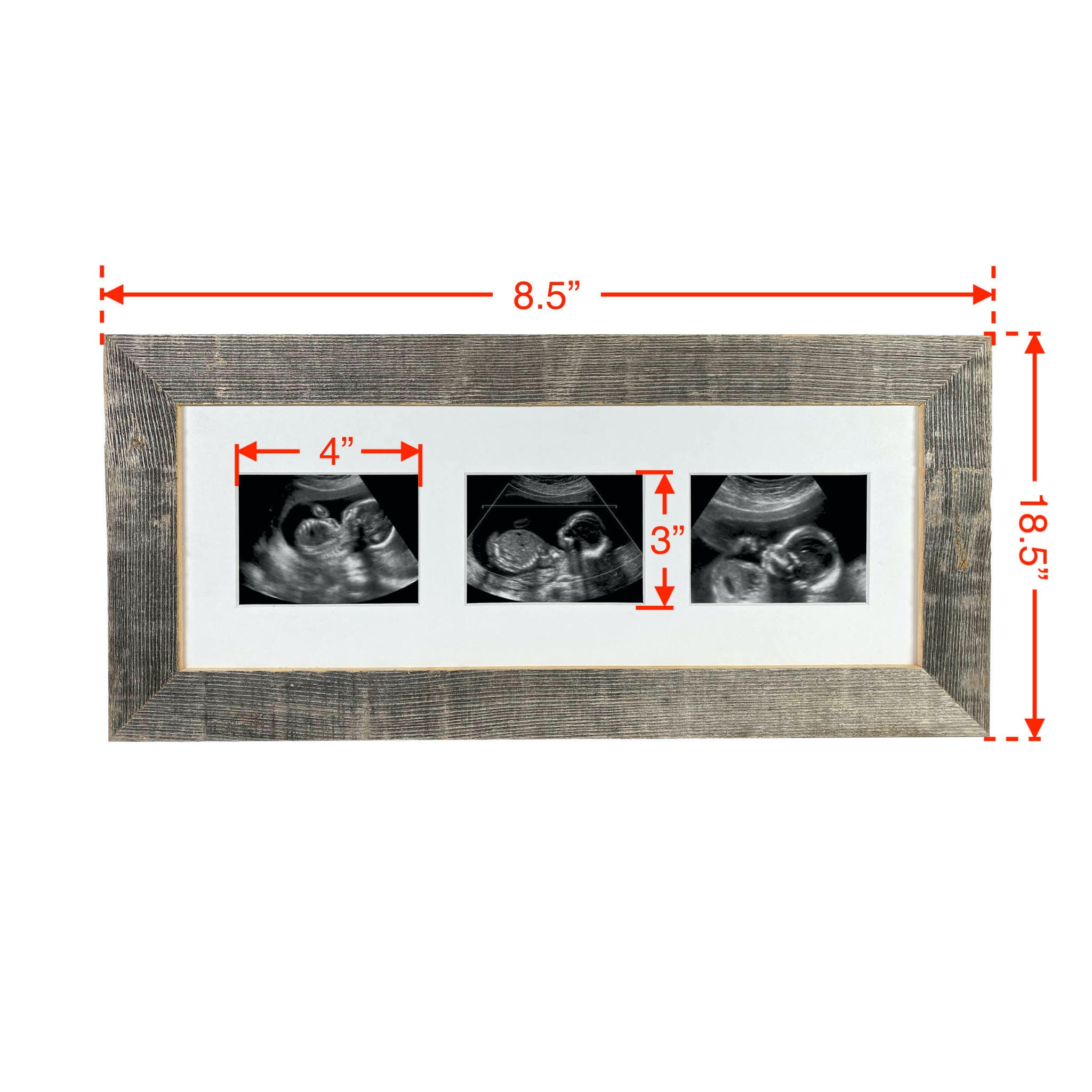 Sonogram Picture Frame baby Ultrasound Trimester Progression