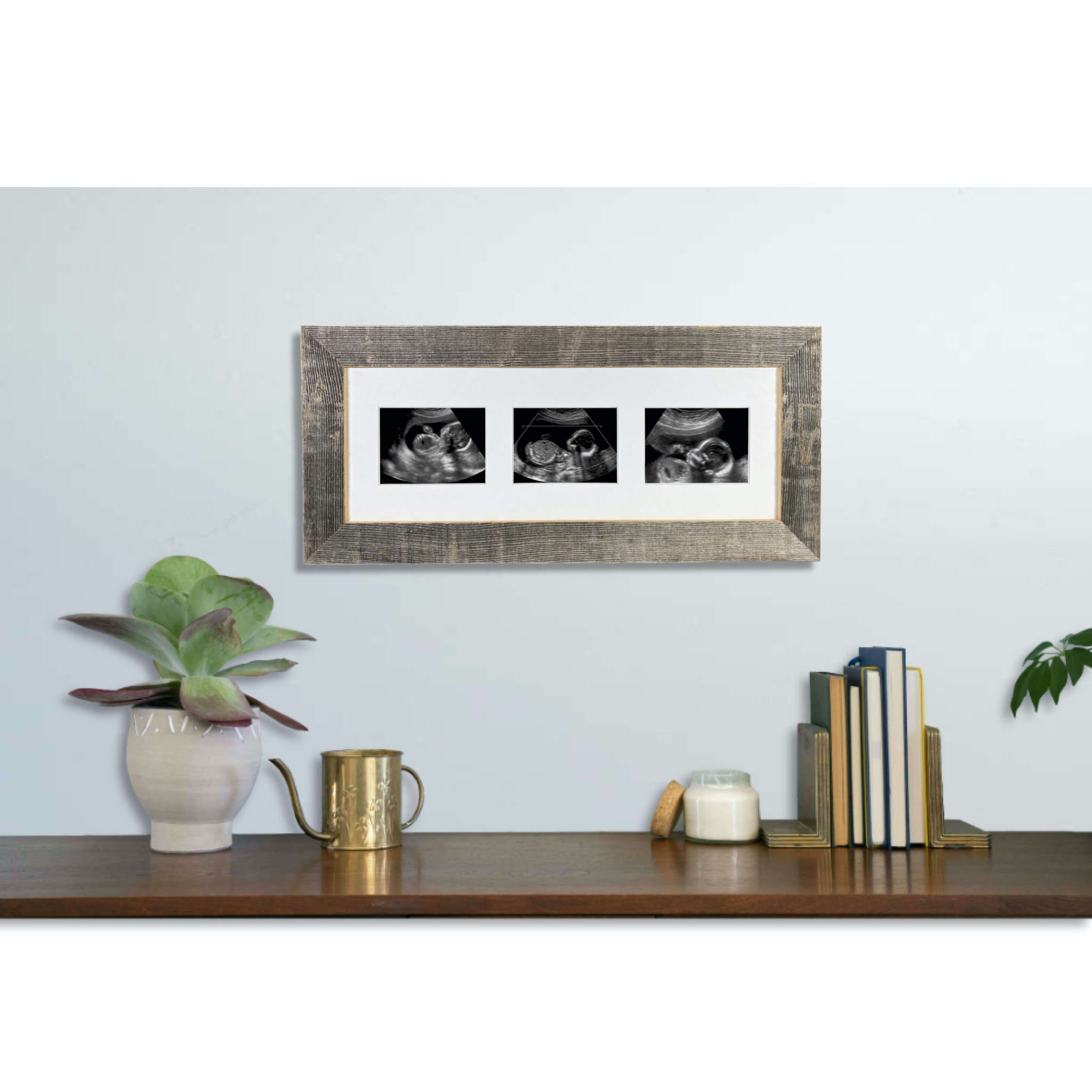 Sonogram Picture Frame baby Ultrasound Trimester Progression