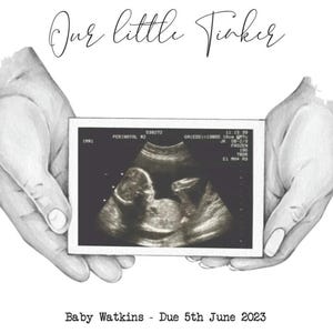 Baby scan picture, love at first heart beat, pregnancy announcement, new parent gift, ultrasound, scan print gift, baby girl, baby boy,