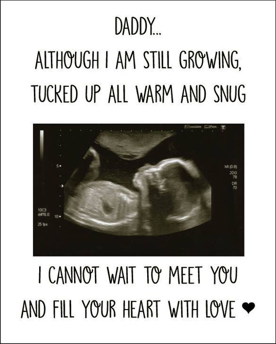 Baby scan picture, daddy gift, Christmas gift for daddy, father's day,  personalised gift for dad, father gift, gift for him, daddy to be,