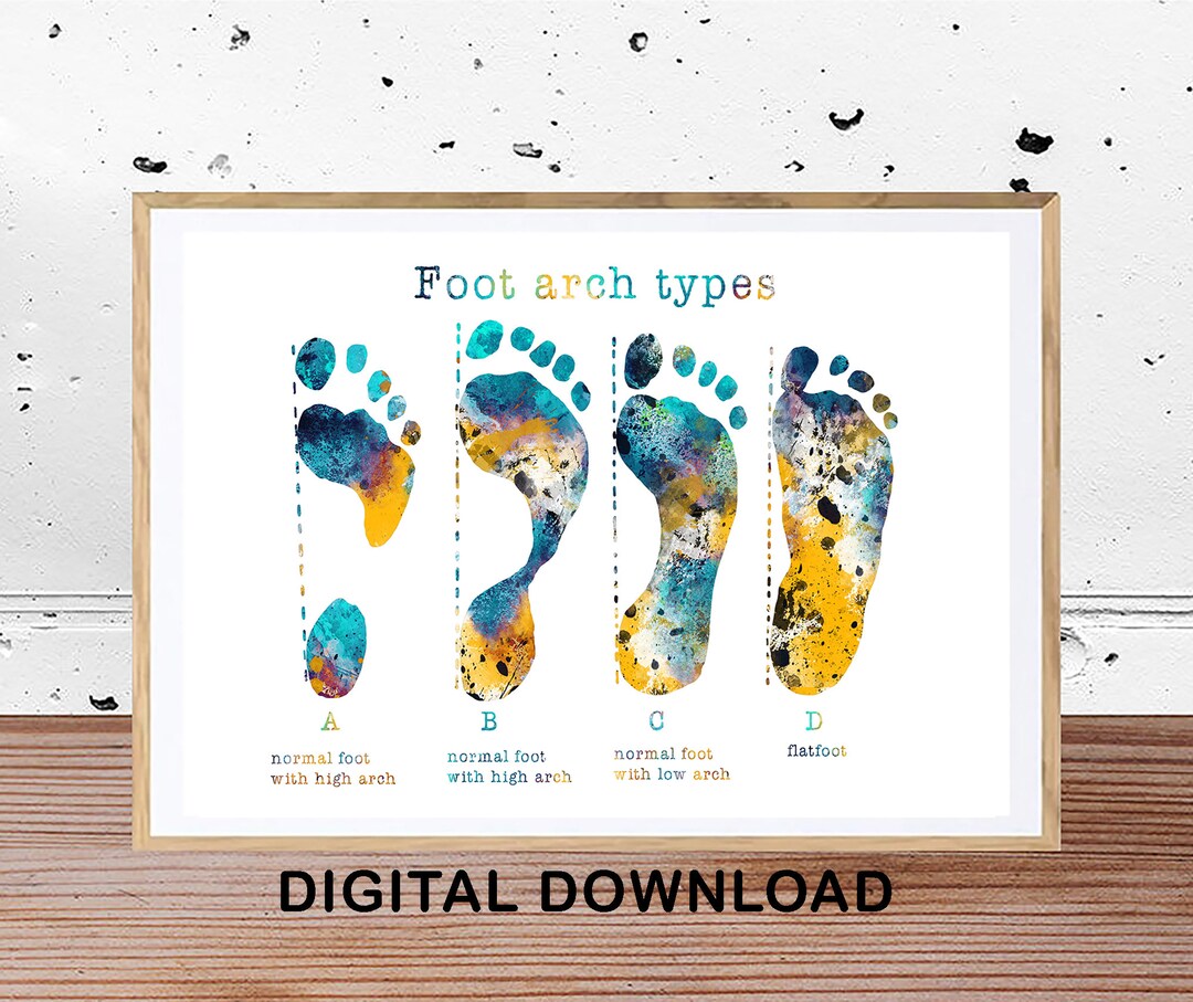 Types of Footprints Printable Wall Art Foot Arch Types Watercolor Print