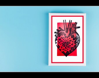 Love&#39;s Anatomy Wood Cut Lithograph Print - DayGlo Variant - Black Light Reactive - 8&#39;&#39; x 10&#39;&#39;, Original Art Print, Unframed Valentine&#39;s Gift