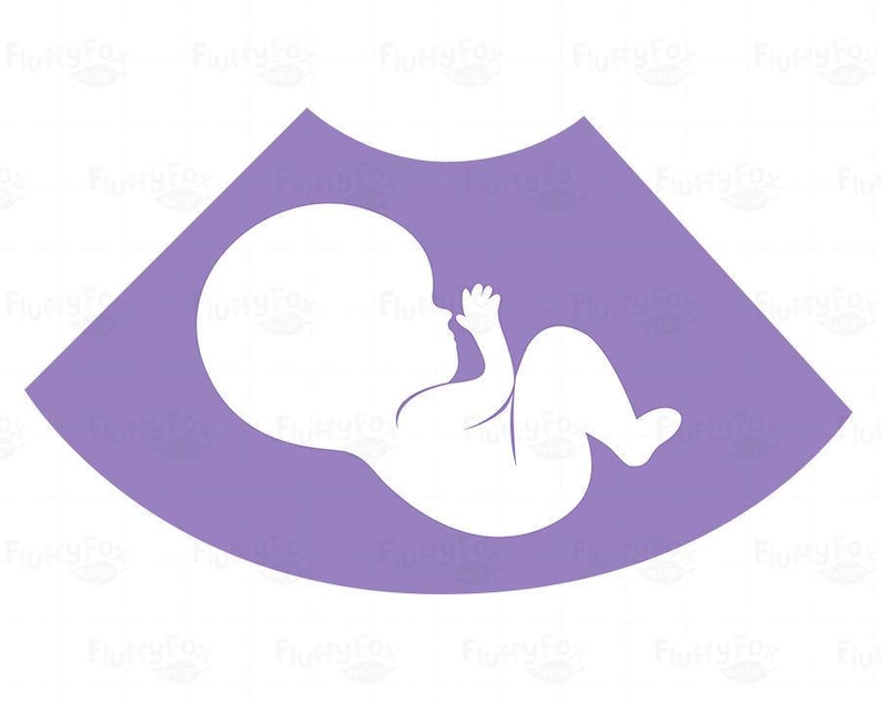 Sonogram Clipart, Échographie Grossesse maternité enceinte Ultasonography New Baby Rainbow PNG, Utilisation commerciale image 4