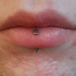 1 PC-18g 16g - 6 8 10 12   mm - Implant Grade Titanium - Vertical Lip Ring - Internally Threaded
