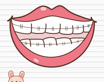 Braces SVG, Mouth PNG, Smiling Teeth, Lips, SVG Files for Cricut, digital download by KawaiiArt1980