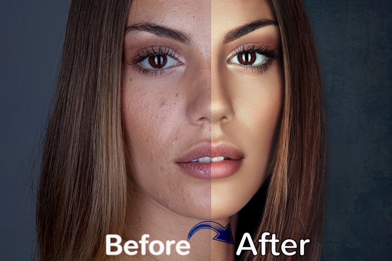 May include: A split image showing a woman's face before and after a beauty treatment. The left side displays skin imperfections, while the right side shows a flawless complexion. The text "Before" and "After" are at the bottom.
