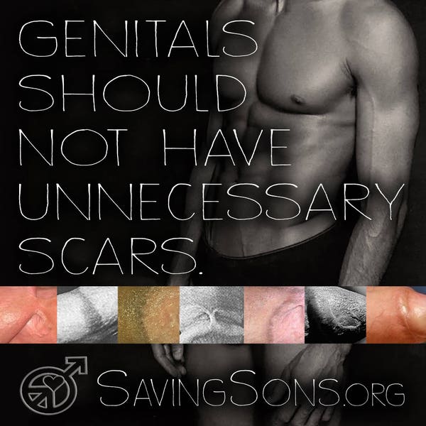 Genitals Should Not Have Unnecessary Scars