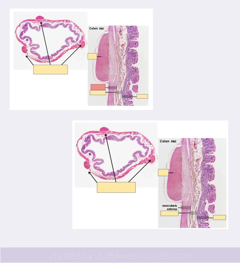 Medicine ANKI Flashcards Year 1 MBBS Study Guide Etsy