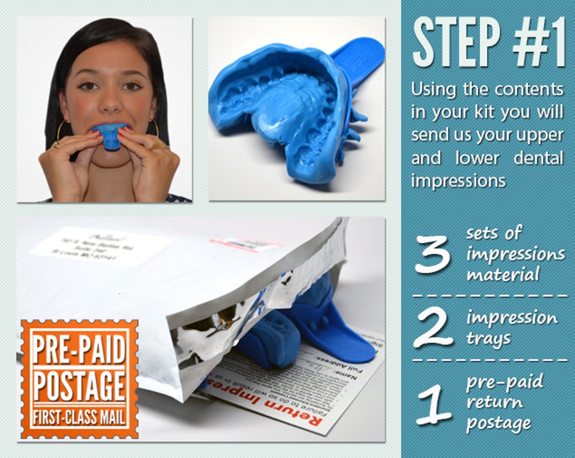 Professional Custom Teeth Whitening Tray Kit USA Dental Lab Etsy