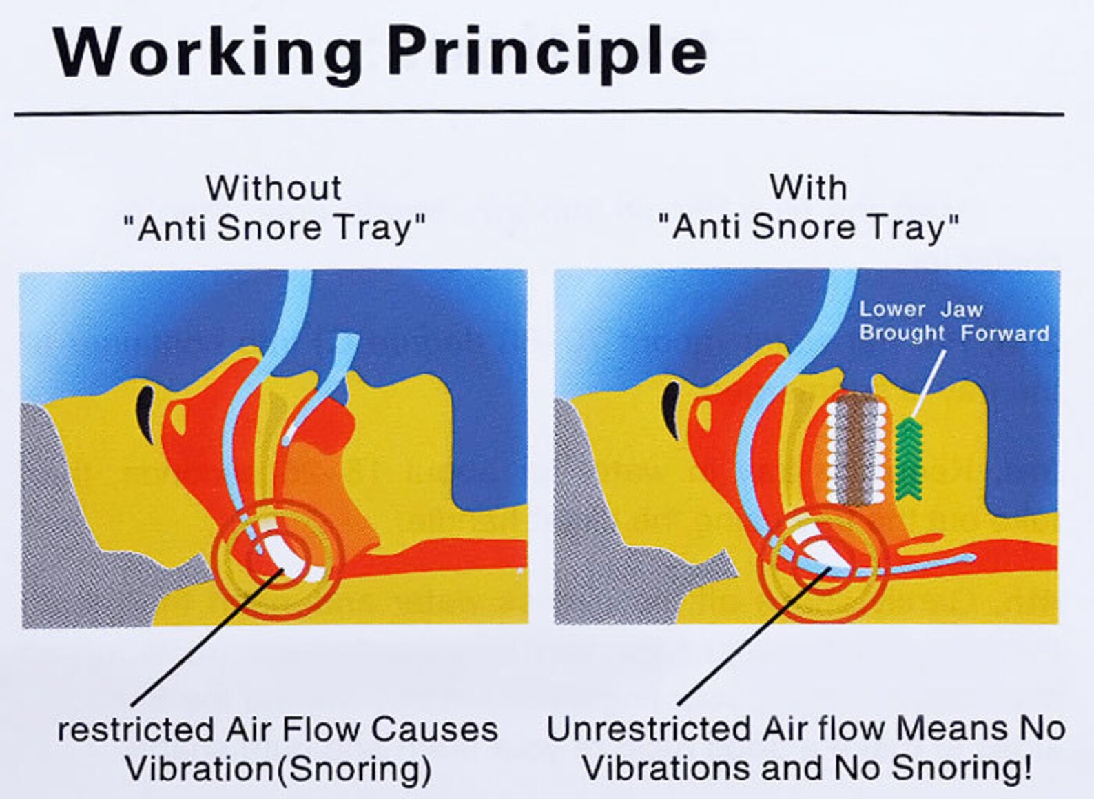 Ultimate Anti Snore Mouthpiece Made In USA Sleep Mouthguard Etsy