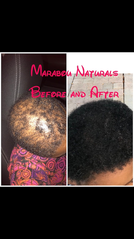Fenugreek Hair Growth Butter Fenugreek Butterfast Hair - Etsy Fenugreek Hair Growth Butter Fenugreek Butterfast Hair - Etsy
