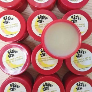 Eczema Lotion- Natural Herb and Essential Oil Healing Eczema Lotion