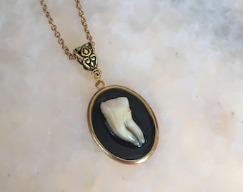 Filigree Tooth Fairy Necklace