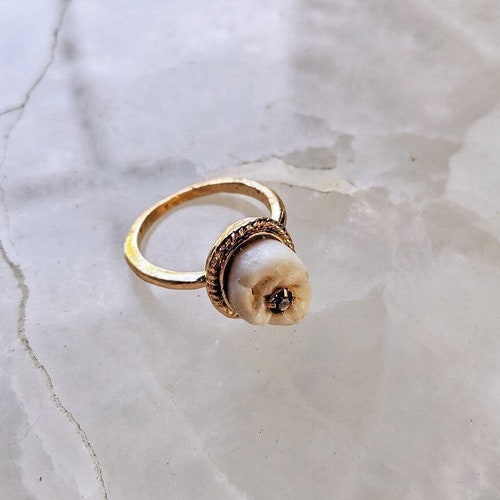 Human Molar Purple Cavity Ring