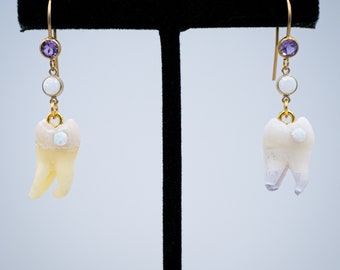 Tooth Fairy's Opal Molar Earrings