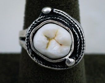 Human Molar Industrial Ring