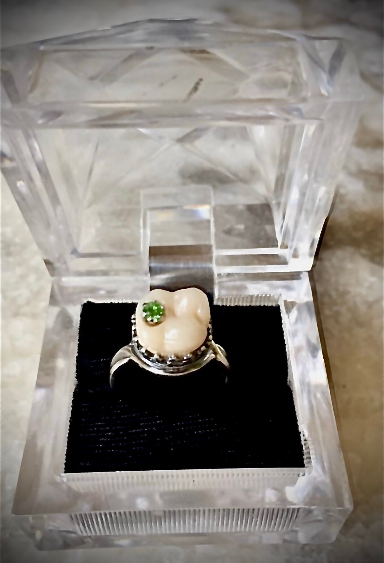 70-year-old woman discovers a rare pearl in dinner, uses it for an  engagement ring