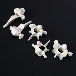 Lot of 5 vertebrae bones!