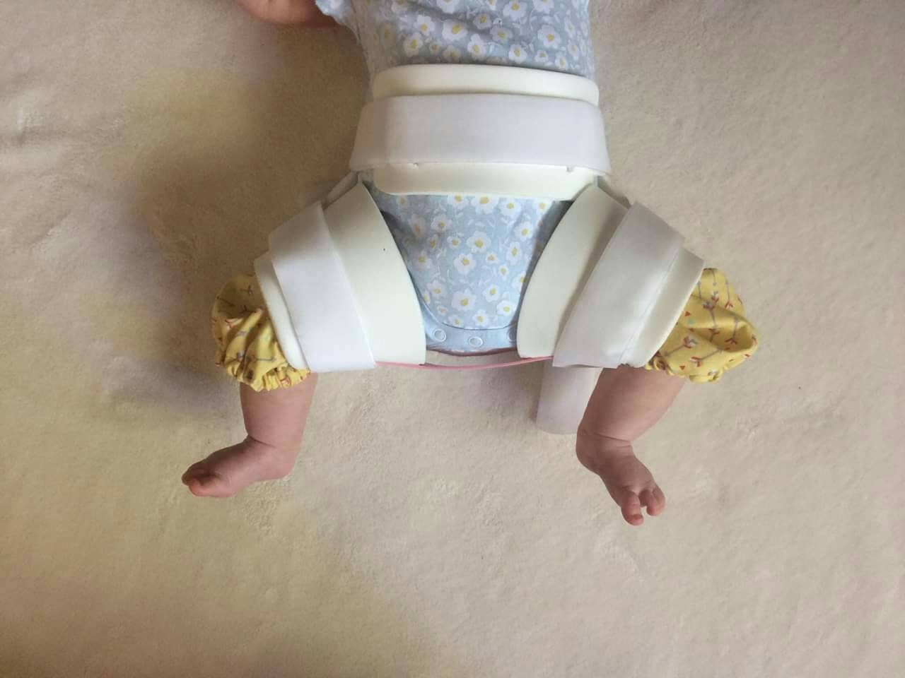 Hip Dysplasia Rhino & DBB Leg Cuffs Brace Covers Hip Etsy