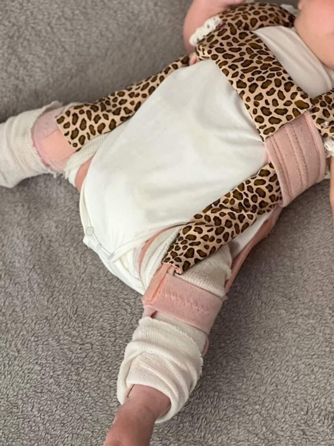 Pavlik Harness Brace Covers Hip Dysplasia Brace Covers Brace Covers