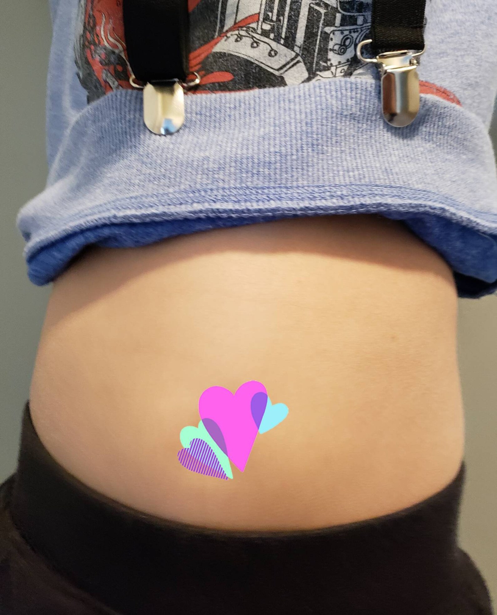 Urostomy Bag Change Straps /ostomy Bag Change Accesssories Etsy