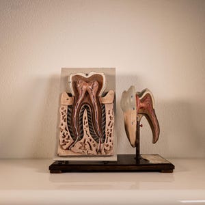Può includere: Un modello anatomico di un dente umano con una sezione trasversale su un pannello rettangolare e un modello di dente tridimensionale separato montato su una base marrone scuro, che mostra strutture interne come la polpa, la dentina e le radici.