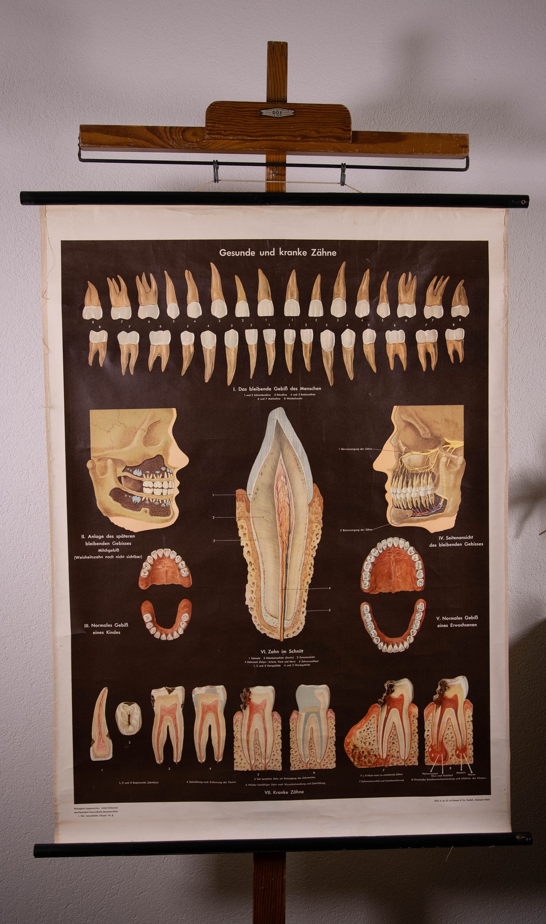 Vintage Pull Down Chart Healthy and Diseased Teeth School Chart - Etsy