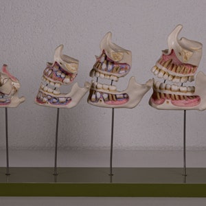 Könnte beinhalten: Ein Set aus vier anatomischen Kiefermodellen, die auf dünnen Metallstäben an einer rechteckigen grünen Basis befestigt sind. Die Modelle zeigen den Fortschritt der menschlichen Zahnentwicklung vom Säuglings- bis zum Erwachsenenalter.