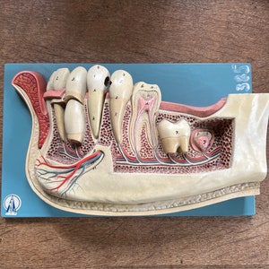 Vintage Anatomical Jaw Model – Hand-Painted Lower Mandible – Dental Teaching Aid – Medical Decor – Curiosity Cabinet – Science Model