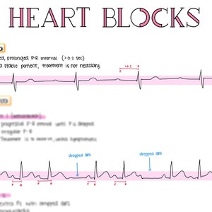 Heart Blocks Study Sheet