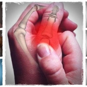 May include: Collage of images depicting joint pain, including knees, shoulders, and hands. One image highlights a hand with a red, inflamed area, showing bone structure. The overall theme is related to health and medical conditions.