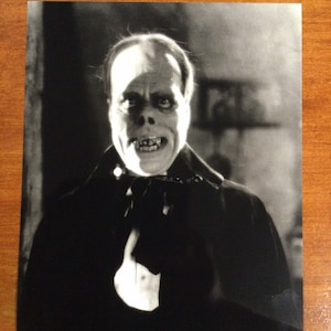 May include: Black and white photograph of a man with a disfigured face. He is wearing a dark suit and a white bow tie. The man is looking directly at the camera with a serious expression.