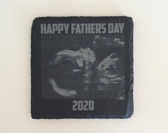 Scan Photo Coaster Fathers Day. Mothers Day, Baby Scan. New Baby. Christening gifts. Announcement. Baby shower. New Parents. New Dad