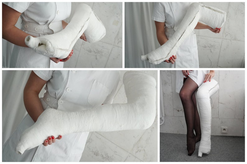 Long Leg Cast Plaster Cast With Toe Spica / Medical / Used / Etsy