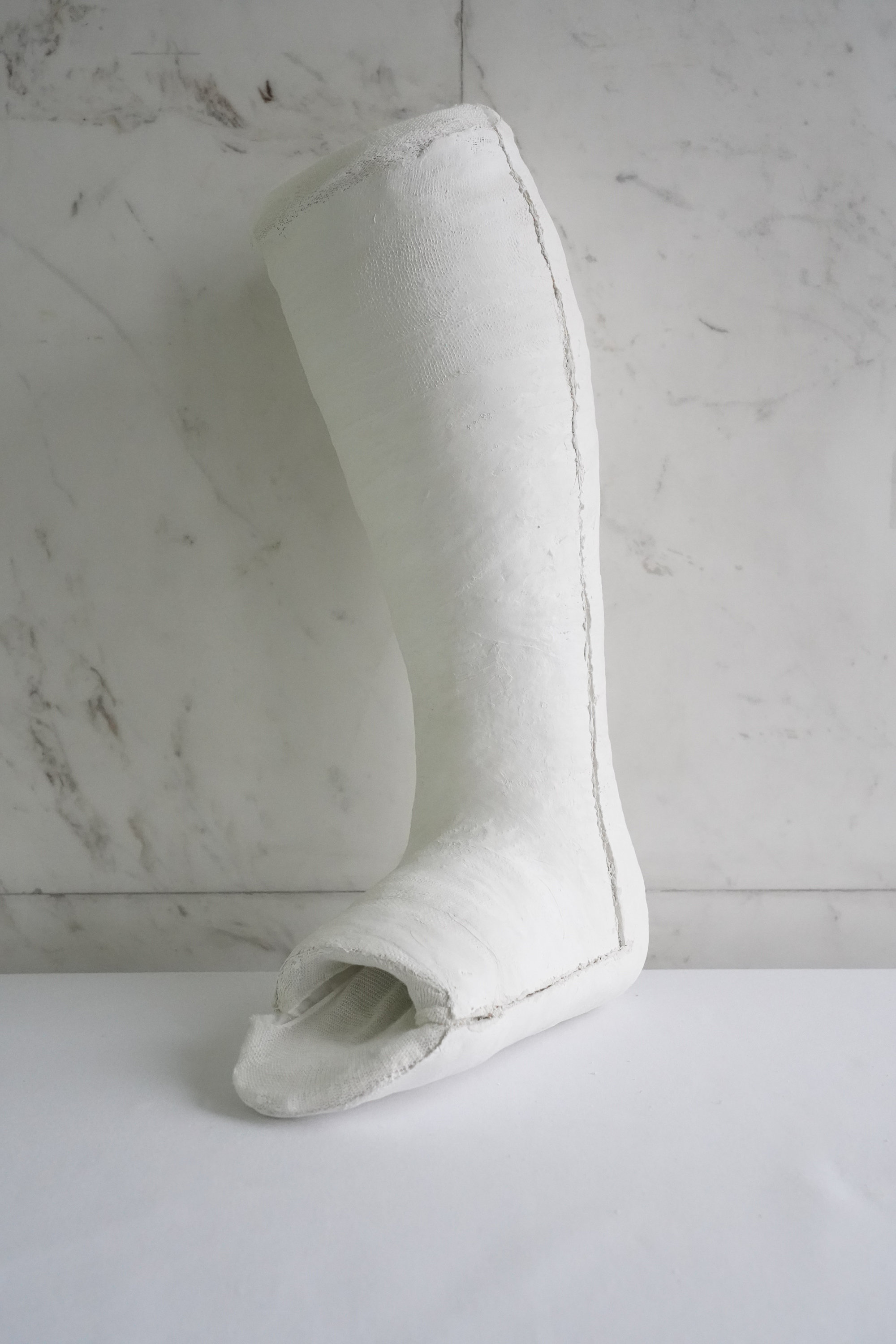 Below knee cast – Plaster Room
