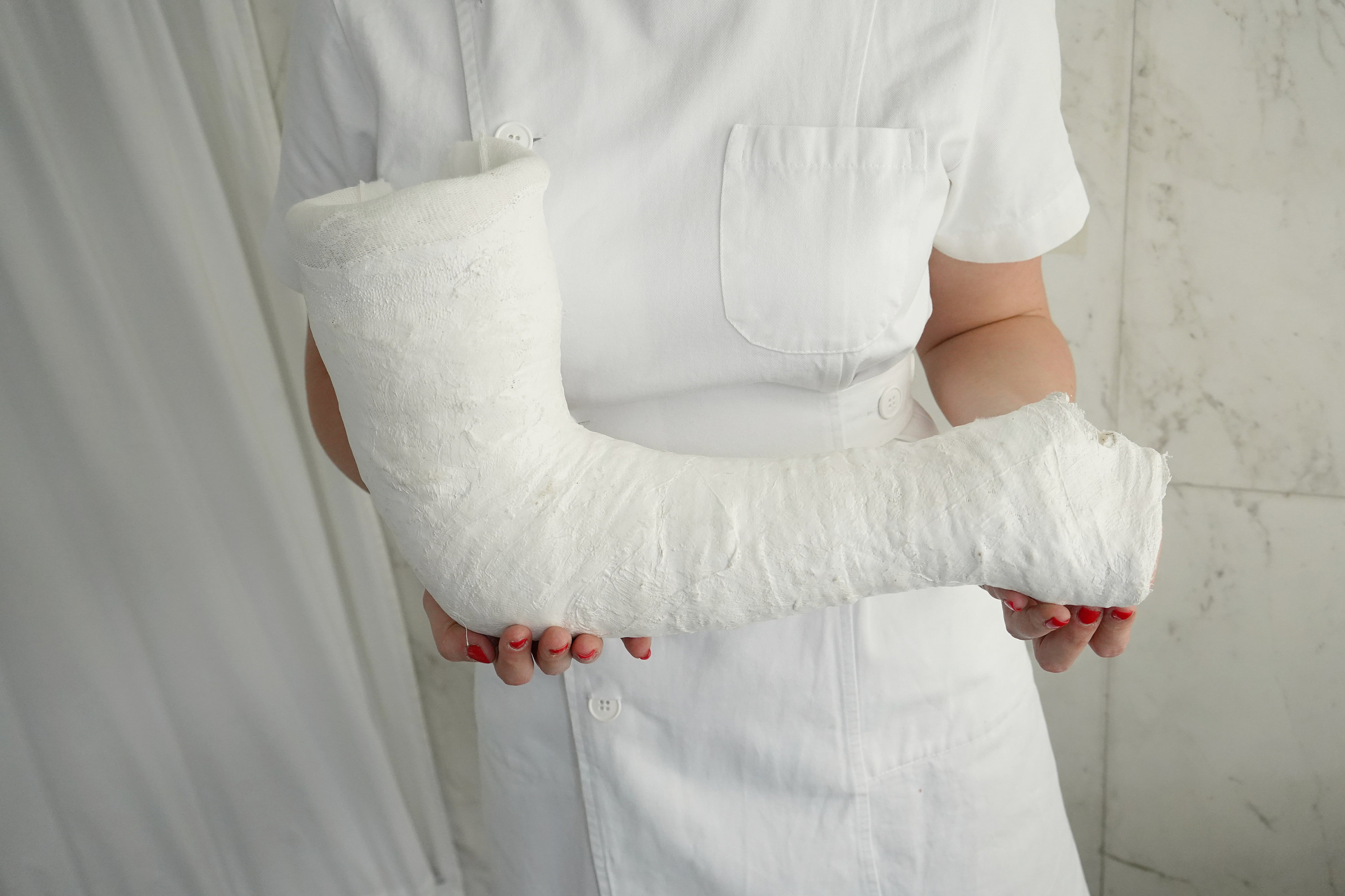 Long Leg Cast Plaster Cast With Toe Spica and Long Arm Cast / Etsy UK