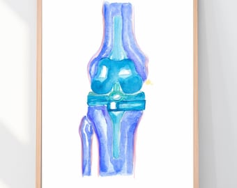 Knee Replacement Surgery Anatomy Art, Orthopedic Artwork, Physical Therapist and Orthopedic Surgeon Gift