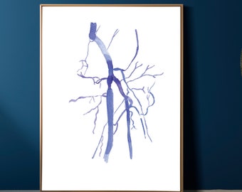 Femoral Artery Angiography, Vascular Surgery Radiography Anatomy Art Print, Gift for Vascular Surgeon Radiology Tech Angiology