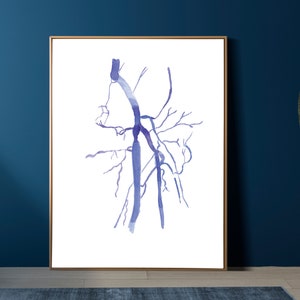 Femoral Artery Angiography, Vascular Surgery Radiography Anatomy Art Print, Gift for Vascular Surgeon Radiology Tech Angiology
