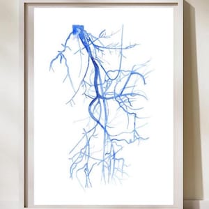 Angiografie arteria iliaca et femoralis, kunst vaatchirurgie, kunst DSA-radiologie, cadeau vaatchirurg, vaatanatomie onderste ledematen