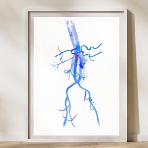Aorta Aneurysm, Abdominal Aorta, Interventional Radiology Art, Radiologist Gift, Vascular Surgery Art, Aorta Anatomy, Radiology Decor