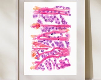 Melanom Nävus, Haut Histologie, Pathologie Kunst, Geschenk für Pathologen Assistent, Dermatologie Büro Dekor, Onkologie Kunst, Pathologie Malerei