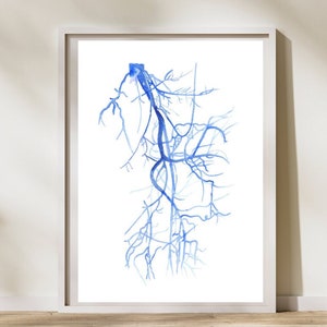 Arteria Iliaca et Femoralis  Angiography, Vascular Surgery Art, DSA Radiology Art, Vascular Surgeon Gift, Lower Limb Vascular Anatomy