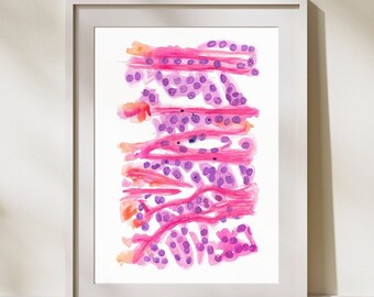Melanoma Nevus Skin Histopathology, Dermatopathology Art Print, Gift for Pathologist Assistant, Dermatology Office Decor, Oncology Artwork
